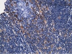 KHK Mouse anti-Human, Clone: OTI3D1, lyophilized, TrueMAB 100 &mu;g; Unconjugated:Antibodies,
