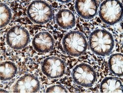 KHK Mouse anti-Human, Clone: OTI3D1, lyophilized, TrueMAB 100 &mu;g; Unconjugated:Antibodies,