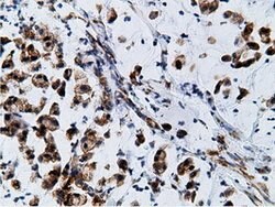 KHK Mouse anti-Human, Clone: OTI3D1, lyophilized, TrueMAB 100 &mu;g; Unconjugated:Antibodies,