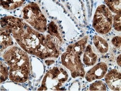 KHK Mouse anti-Human, Clone: OTI3D1, lyophilized, TrueMAB 100 &mu;g; Unconjugated:Antibodies,