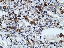 KHK Mouse anti-Human, Clone: OTI3D1, lyophilized, TrueMAB 100 &mu;g; Unconjugated:Antibodies,