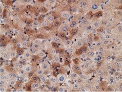 KHK Mouse anti-Human, Clone: OTI3D1, lyophilized, TrueMAB 100 &mu;g; Unconjugated:Antibodies,
