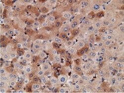 KHK Mouse anti-Human, Clone: OTI3D1, liquid, TrueMAB 100 &mu;L; Unconjugated:Antibodies,