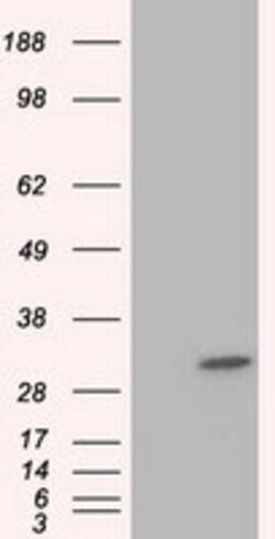 KHK Mouse anti-Human, Clone: OTI1F1, lyophilized, TrueMAB 100 &mu;g; Unconjugated:Antibodies,