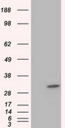 KHK Monoclonal Antibody (OTI1F1), TrueMAB , OriGene 30 &mu;L; Unconjugated:Antibodies,