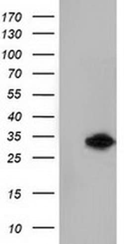 KHK Mouse anti-Human, Clone: OTI3D1, liquid, TrueMAB 100 &mu;L; Unconjugated:Antibodies,