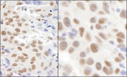 KIAA0082 Rabbit anti-Human, Mouse, Polyclonal, Bethyl Laboratories 100