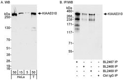 KIAA0310 Rabbit anti-Human, Polyclonal, Bethyl Laboratories 100 &mu;L;