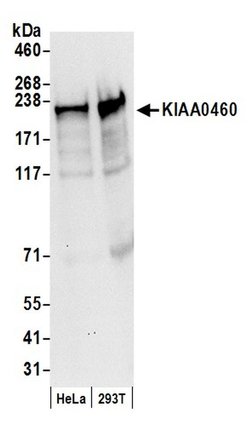 KIAA0460 Polyclonal Antibody, Bethyl Laboratories 20 &mu;l; Unlabeled:Antibodies,