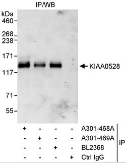 KIAA0528 Rabbit anti-Human, Polyclonal, Bethyl Laboratories 100 &mu;L;