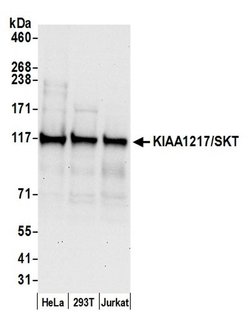 KIAA1217/SKT Polyclonal Antibody, Bethyl Laboratories:Antibodies:Primary