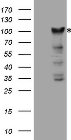 KIAA1524 Monoclonal Antibody (OTI1C11), TrueMAB , OriGene 100 &mu;L; Unconjugated:Antibodies,