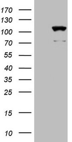 KIAA1524 Monoclonal Antibody (OTI9E6), TrueMAB , OriGene:Antibodies:Primary