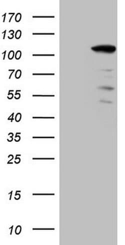 KIAA1524 Monoclonal Antibody (OTI2A1), TrueMAB , OriGene 100 &mu;L; Unconjugated:Antibodies,