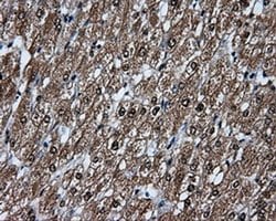 KIAA1609 Monoclonal Antibody (OTI5D9), TrueMAB , OriGene 30 &mu;L; Unconjugated:Antibodies,