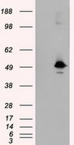 KIAA1609 Monoclonal Antibody (OTI7E4), TrueMAB , OriGene 100 &mu;L; Unconjugated:Antibodies,