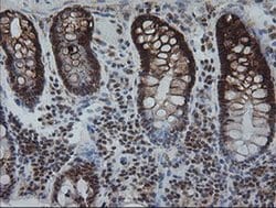 KIF25 Monoclonal Antibody (OTI2F4), TrueMAB , OriGene 100 &mu;L; Unconjugated:Antibodies,