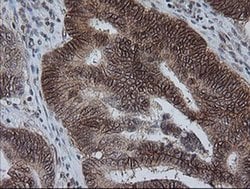 KIF25 Monoclonal Antibody (OTI2F4), TrueMAB , OriGene 100 &mu;L; Unconjugated:Antibodies,