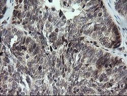 KIF25 Monoclonal Antibody (OTI2C9), TrueMAB , OriGene 30 &mu;L; Unconjugated:Antibodies,