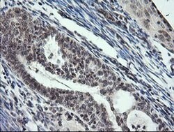 KIF25 Monoclonal Antibody (OTI2C9), TrueMAB , OriGene 30 &mu;L; Unconjugated:Antibodies,
