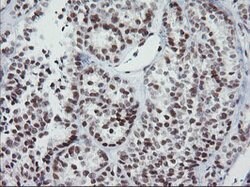 KIF25 Mouse anti-Human, Clone: OTI2D6, lyophilized, TrueMAB 100 &mu;g;