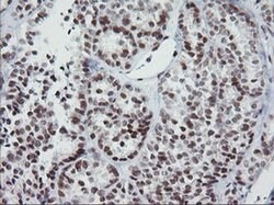 KIF25 Monoclonal Antibody (OTI2D6), TrueMAB , OriGene 100 &mu;L; Unconjugated:Antibodies,