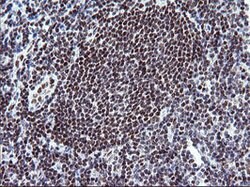 KIF25 Mouse anti-Human, Clone: OTI2D6, lyophilized, TrueMAB 100 &mu;g;