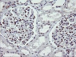 KIF25 Monoclonal Antibody (OTI2D6), TrueMAB , OriGene 100 &mu;L; Unconjugated:Antibodies,