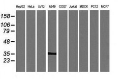 KIF25 Monoclonal Antibody (OTI2F4), TrueMAB , OriGene 100 &mu;L; Unconjugated:Antibodies,
