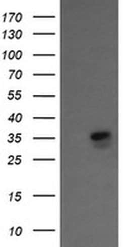 KIF25 Monoclonal Antibody (OTI2C9), TrueMAB , OriGene:Antibodies:Primary