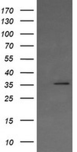 KIF25 Monoclonal Antibody (OTI1H1), TrueMAB , OriGene 30 &mu;L; Unconjugated:Antibodies,