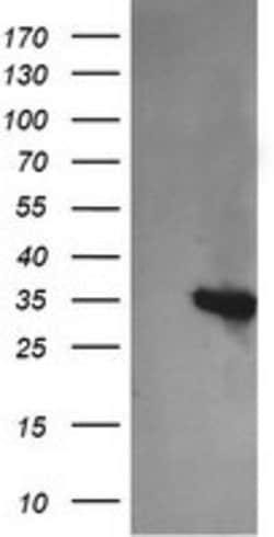 KIF25 Mouse anti-Human, Clone: OTI1H10, lyophilized, TrueMAB 100 &mu;g;