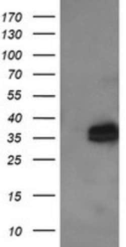 KIF25 Mouse anti-Human, Clone: OTI2D6, lyophilized, TrueMAB 100 &mu;g;