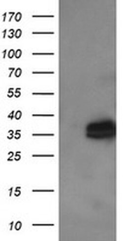 KIF25 Monoclonal Antibody (OTI2D6), TrueMAB , OriGene 100 &mu;L; Unconjugated:Antibodies,