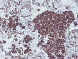 KIF2C Mouse anti-Human, Mouse, Rat, Clone: OTI1C5, liquid, TrueMAB 100