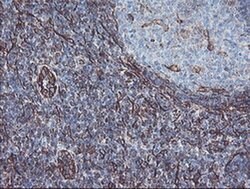 KIF2C Mouse anti-Human, Mouse, Rat, Clone: OTI1C5, liquid, TrueMAB 100