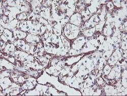 KIF2C Mouse anti-Human, Mouse, Rat, Clone: OTI1C5, liquid, TrueMAB 100