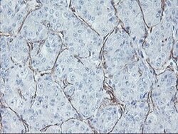 KIF2C Mouse anti-Human, Mouse, Rat, Clone: OTI1C5, liquid, TrueMAB 100