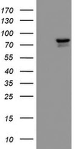 KIF2C Mouse anti-Human, Mouse, Rat, Clone: OTI1C5, liquid, TrueMAB 100