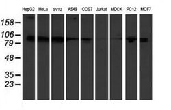 KIF2C Mouse anti-Human, Mouse, Rat, Clone: OTI1C5, liquid, TrueMAB 100