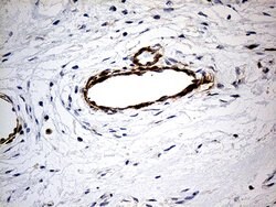 KIF6 Mouse anti-Human, Clone: OTI5G2, lyophilized, TrueMAB 100 &mu;g | Buy Online | Origene Technologies | Fisher Scientific