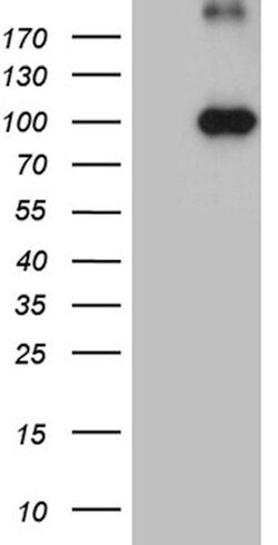 KIF6 Mouse anti-Human, Clone: OTI5G2, lyophilized, TrueMAB 100 &mu;g | Buy Online | Origene Technologies | Fisher Scientific