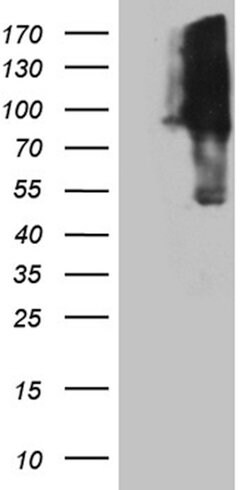 KIF9 Monoclonal Antibody (OTI1A2), TrueMAB , OriGene:Antibodies:Primary