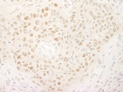 KIFC1 Rabbit anti-Human, Polyclonal, Bethyl Laboratories 100 &mu;L; Unconjugated:Antibodies,