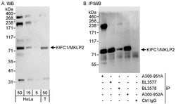 KIFC1 Rabbit anti-Human, Polyclonal, Bethyl Laboratories 100 &mu;L; Unconjugated:Antibodies,