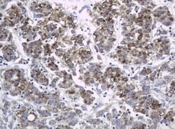 KIT Mouse anti-Human, Clone: OTI1E2, lyophilized, TrueMAB 100 &mu;g; Unconjugated:Antibodies,