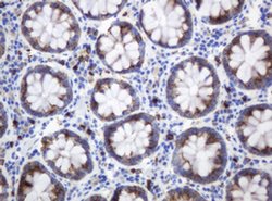 KIT Monoclonal Antibody (OTI2C1D5), TrueMAB , OriGene 100 &mu;L; Unconjugated:Antibodies,