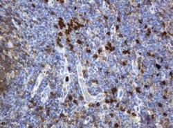 KIT Monoclonal Antibody (OTI9A11), TrueMAB , OriGene:Antibodies:Primary