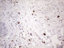 KIT Monoclonal Antibody (OTI1B6), TrueMAB , OriGene:Antibodies:Primary