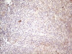 KIT Monoclonal Antibody (OTI1B6), TrueMAB , OriGene:Antibodies:Primary